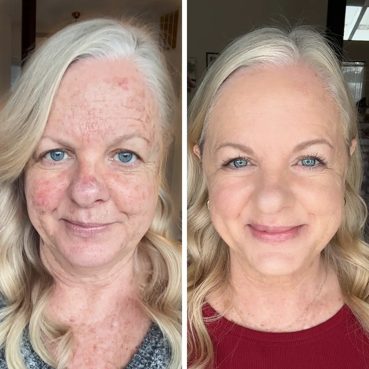 Before and after