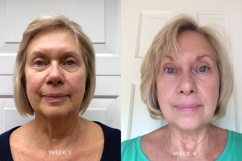 Before and after