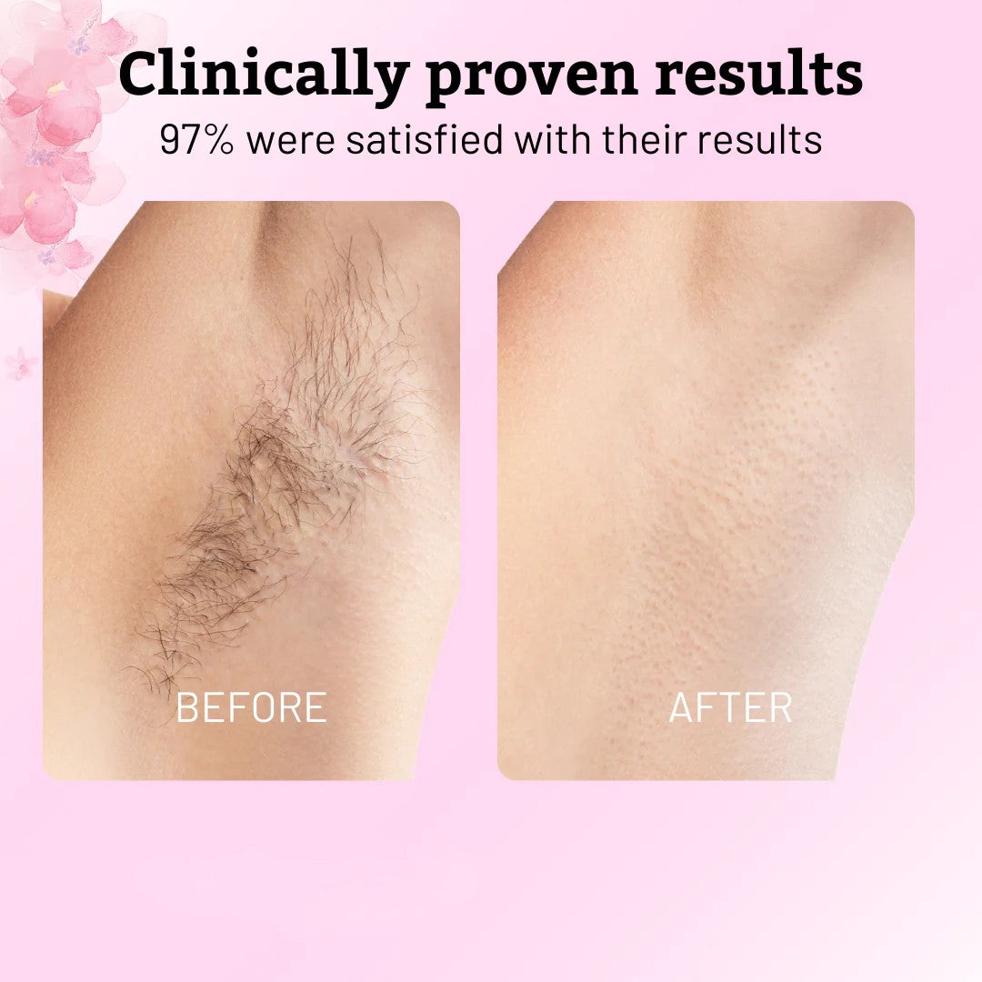 Cyperus Rotundus Oil for Hair Removal