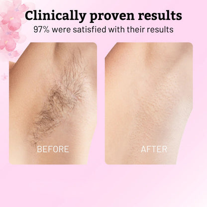 Cyperus Rotundus Oil for Hair Removal